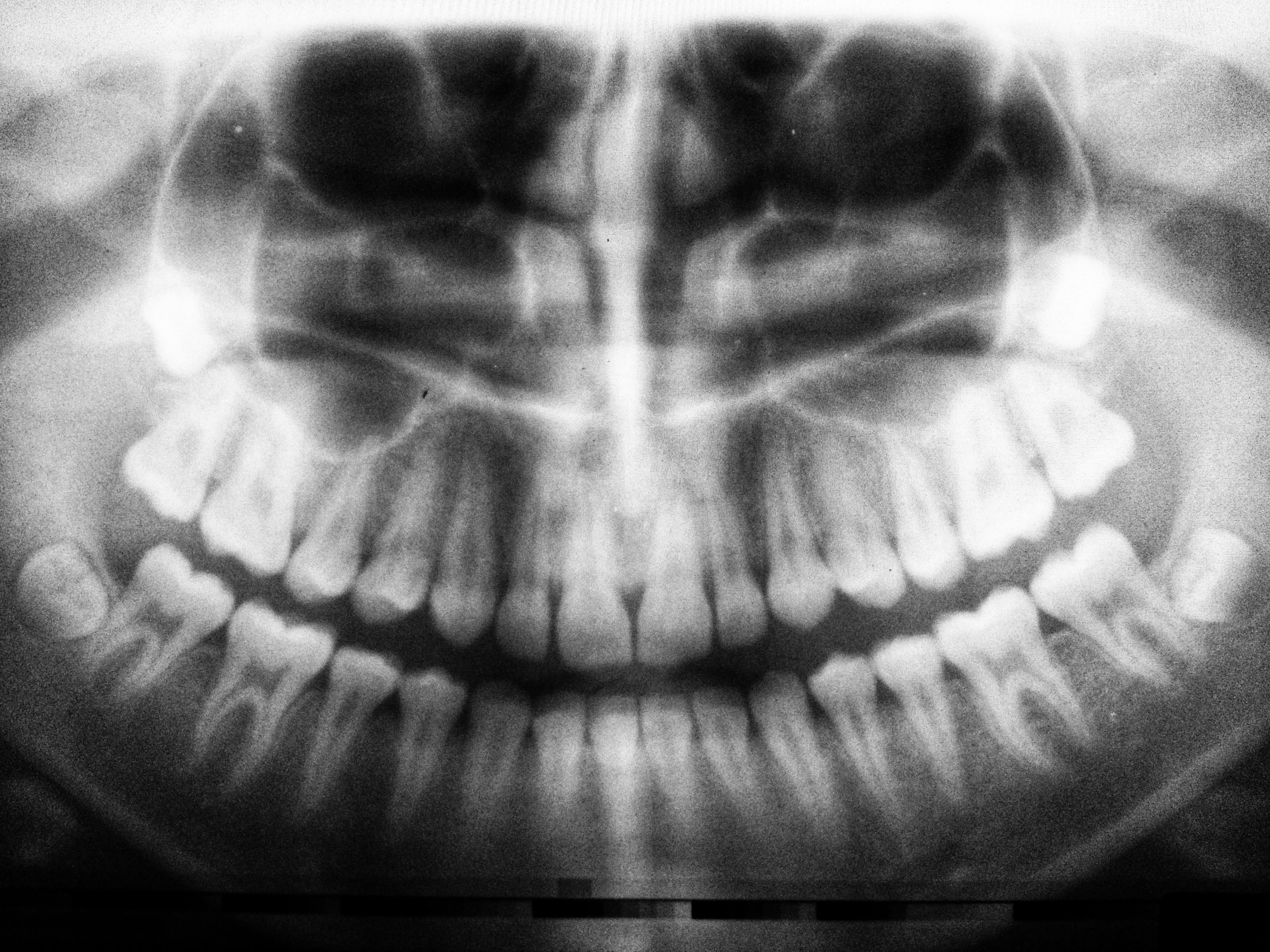 teeth x ray