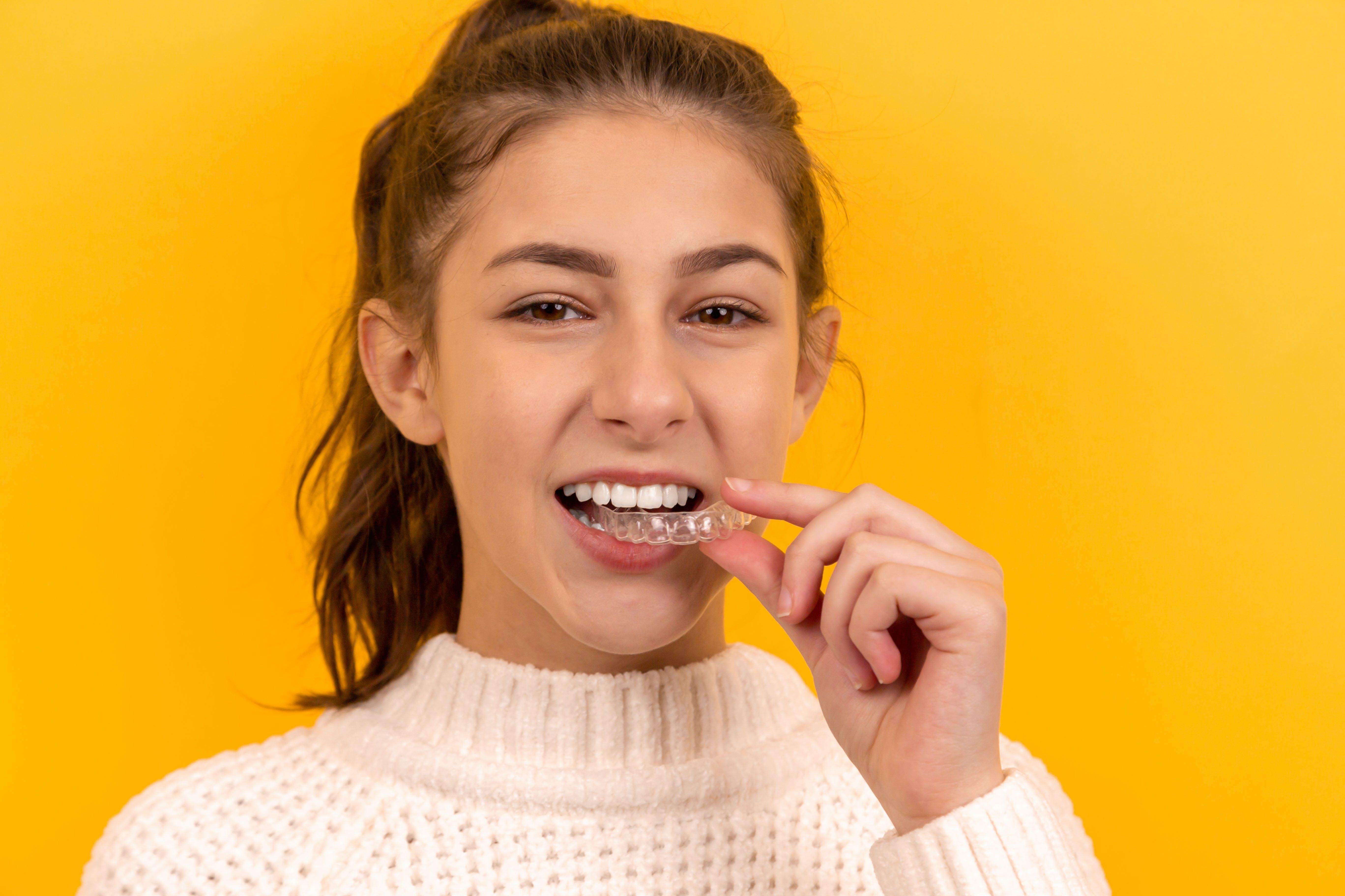 Aligner perfect fit